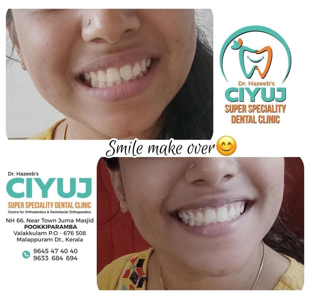 CIYUJ DENTAL CLINIC POOKKIPARAMBA