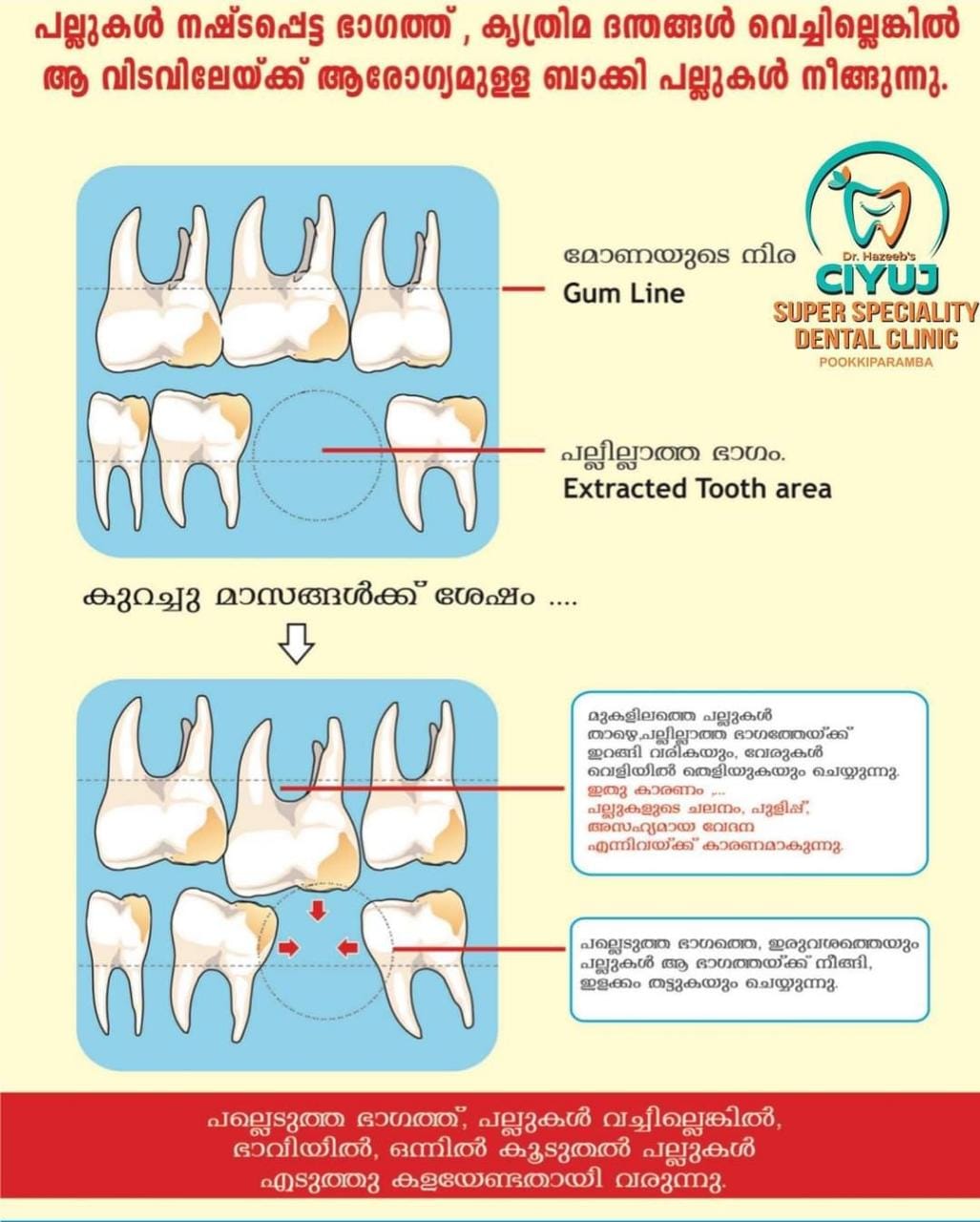 CIYUJ DENTAL CLINIC POOKKIPARAMBA